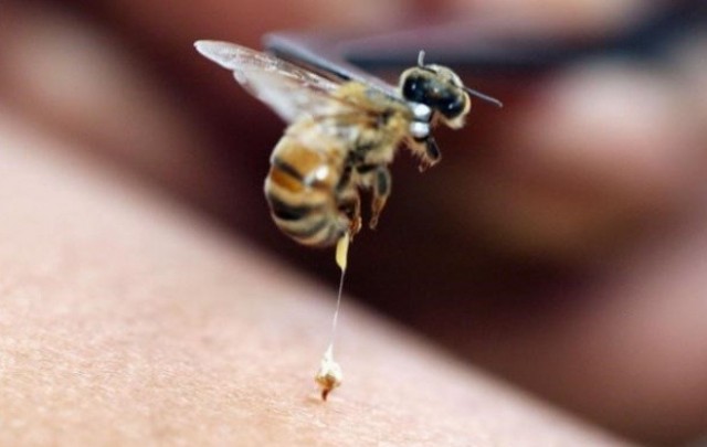 Mahasiswa UGM Ciptakan Gel Sengat Lebah untuk Sembuhkan Luka Operasi Gigi.(Foto: Dok. sidomi.com)