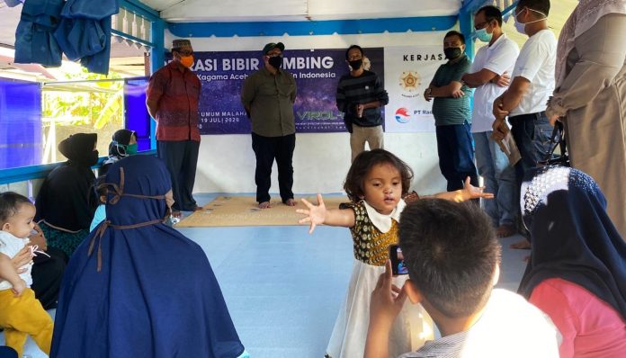 Pengda KAGAMA Aceh menyelenggarakan aksi sosial berupa operasi bibir sumbing gratis bekerja sama dengan gerakan Smile Train. Foto: KAGAMA Aceh